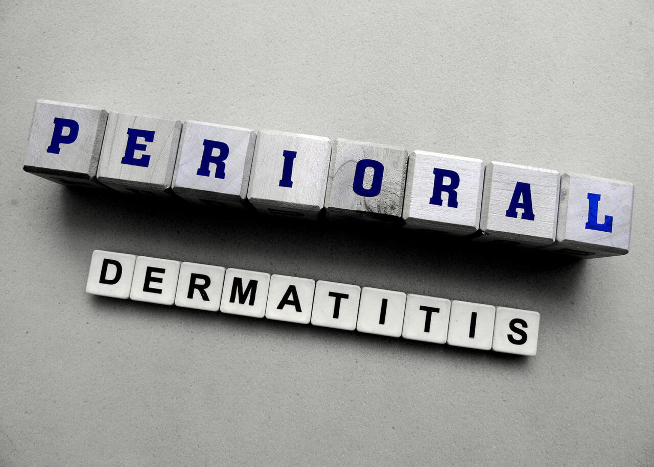 Periorale Dermatitis – Dr. Maike Baumann