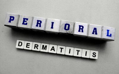 Periorale Dermatitis